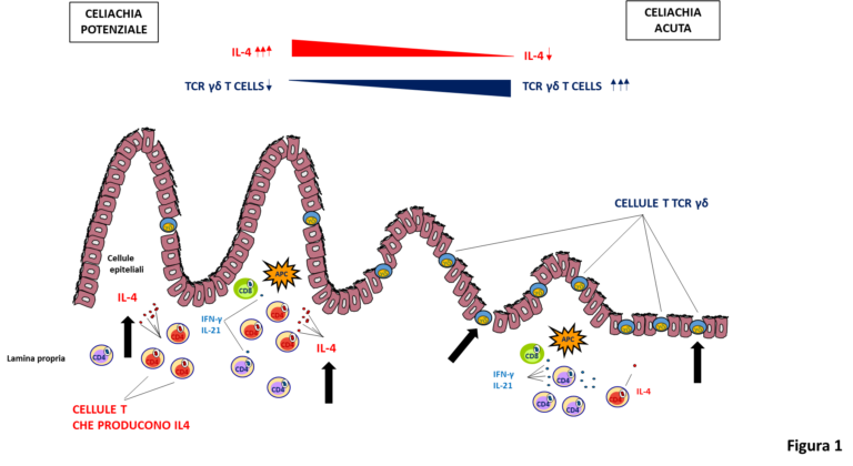 Analisi Della Risposta Immunitaria Indotta Dal Glutine Nelle Differenti ...